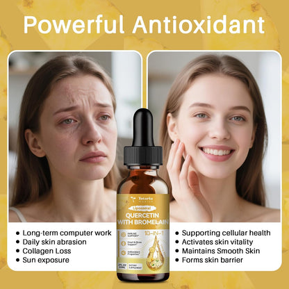 Totaria Liposomal Quercetin with Bromelain Liquid Drops - High Absorption Quercetin 1000mg & Bromelain 500mg Plus Elderberry,Vitamin C,Zinc for Immune & Antioxidant & Heart & Bone Support- 2 Fl Oz