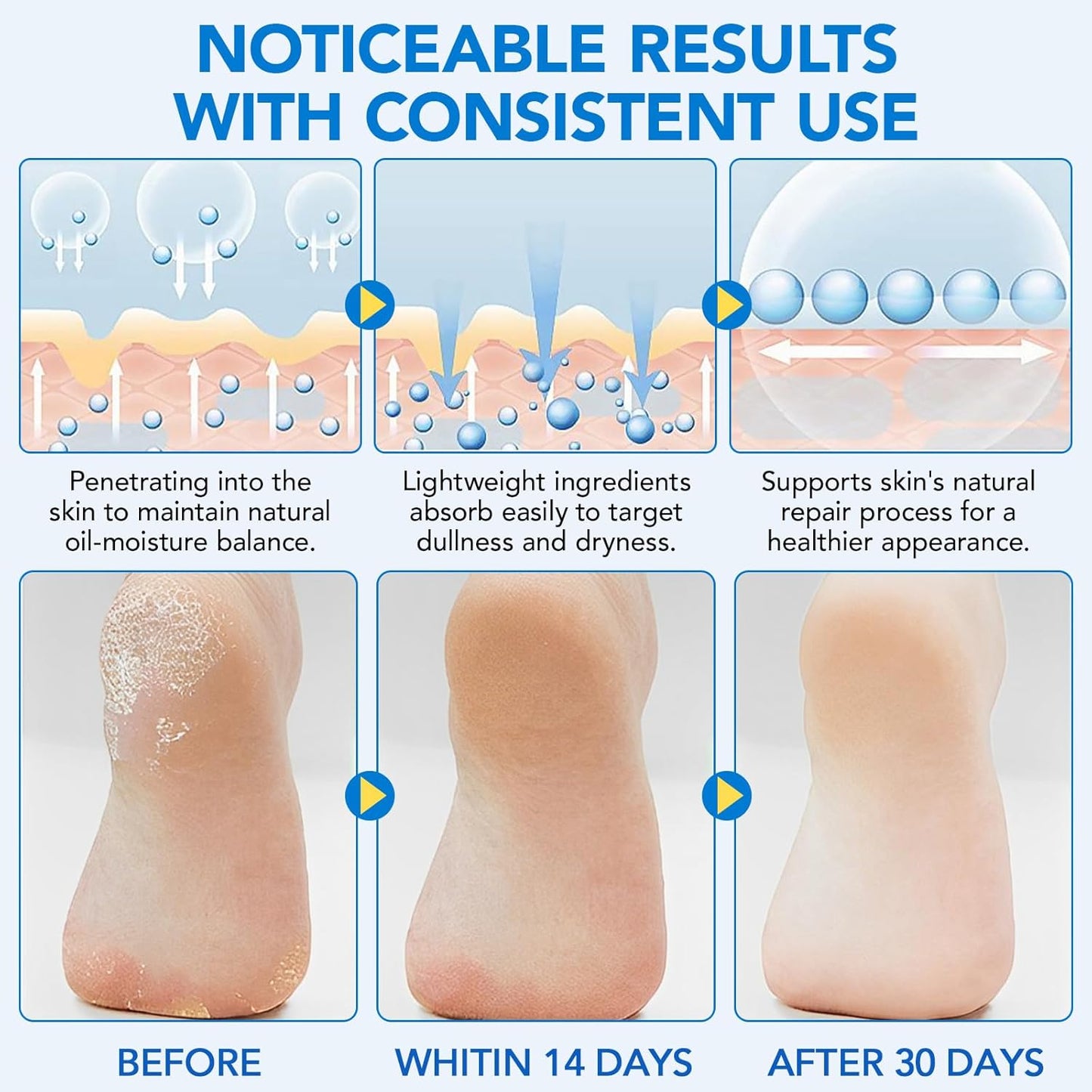 Urea Foot Cream Stick, 60% Urea Cream with 2% Salicylic Acid Foot Care Stick Moisturizer for Dry Cracked Heels, Knees, Hands, Moisturizes & Hydrates Dry Skin, Callus Remover & Skin Softener 1.41 oz