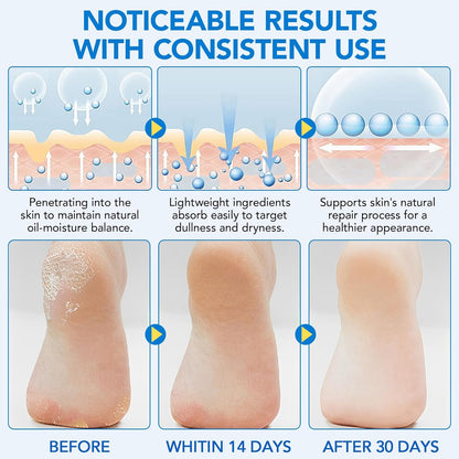 Urea Foot Cream Stick, 60% Urea Cream with 2% Salicylic Acid Foot Care Stick Moisturizer for Dry Cracked Heels, Knees, Hands, Moisturizes & Hydrates Dry Skin, Callus Remover & Skin Softener 1.41 oz