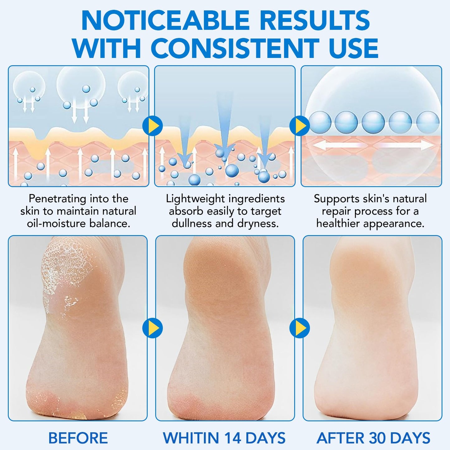 Urea Foot Cream Stick, 60% Urea Cream with 2% Salicylic Acid Foot Care Stick Moisturizer for Dry Cracked Heels, Knees, Hands, Moisturizes & Hydrates Dry Skin, Callus Remover & Skin Softener 1.41 oz