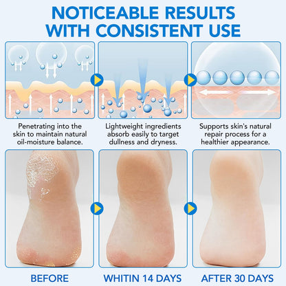 Urea Foot Cream Stick, 60% Urea Cream with 2% Salicylic Acid Foot Care Stick Moisturizer for Dry Cracked Heels, Knees, Hands, Moisturizes & Hydrates Dry Skin, Callus Remover & Skin Softener 1.41 oz