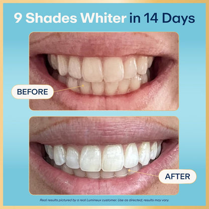 Lumineux Ultimate Whitening Kit Bundle - Contains Toothpaste, Mouthwash, Strips and Whitening Pen - Enamel Safe and Clinically Proven to Whiten Without The Sensitivity - Removes Coffee and Tea Stains