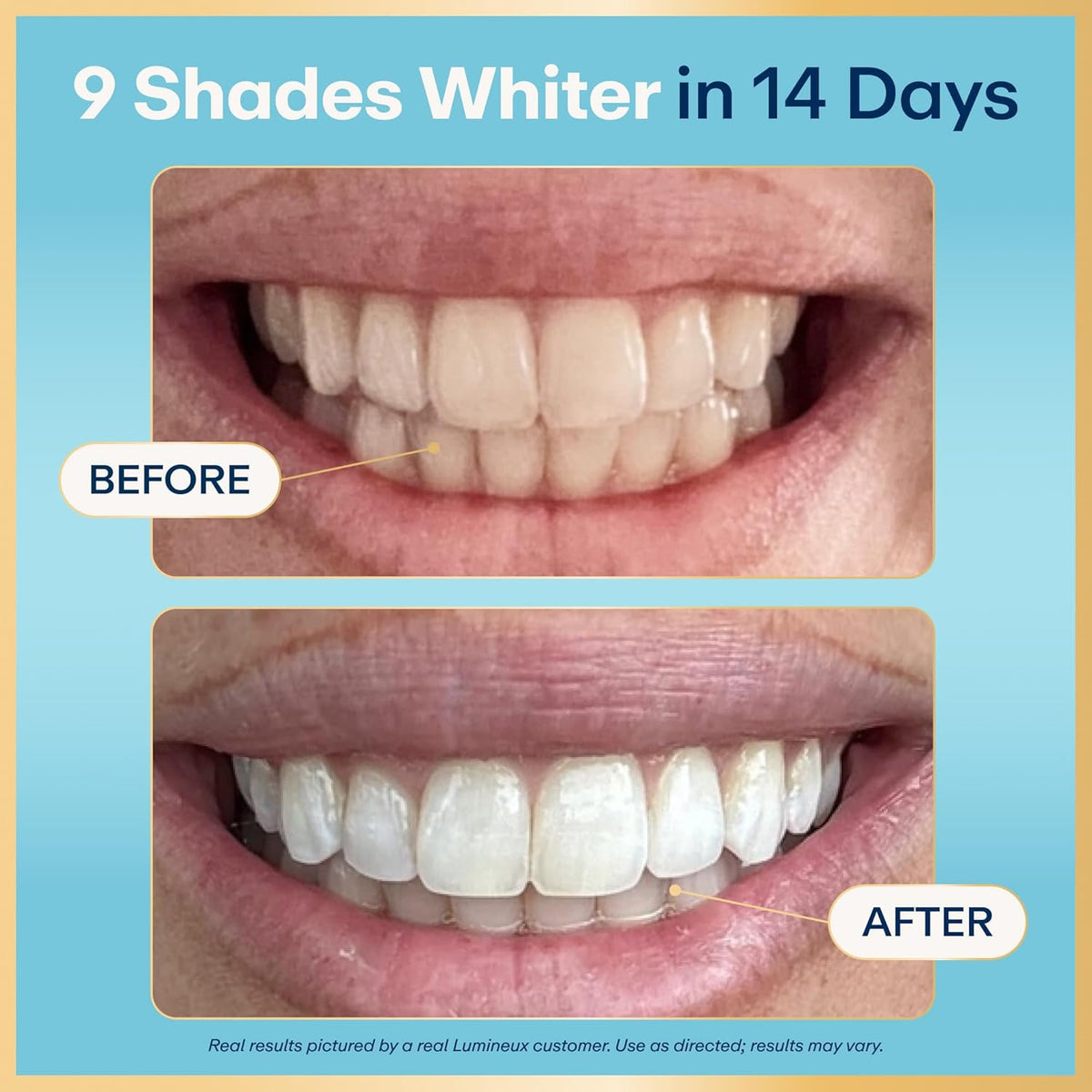 Lumineux Whitening Starter Set, 7 Strip Treatments & Toothpaste 2 Pack
