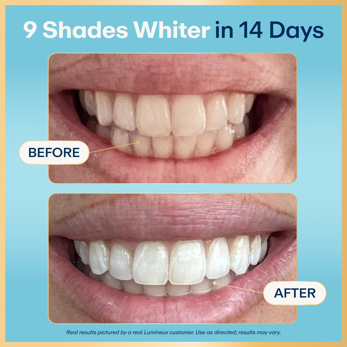 Lumineux Whitening Starter Set, 7 Strip Treatments & Toothpaste 2 Pack