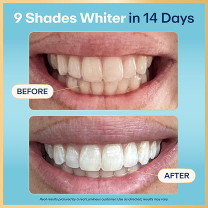 Lumineux Teeth Whitening Strips 9 Treatments – Peroxide Free - Enamel Safe for Whiter Teeth - Whitening Without The Sensitivity - Dentist Formulated and Certified Non-Toxic - Sensitivity Free