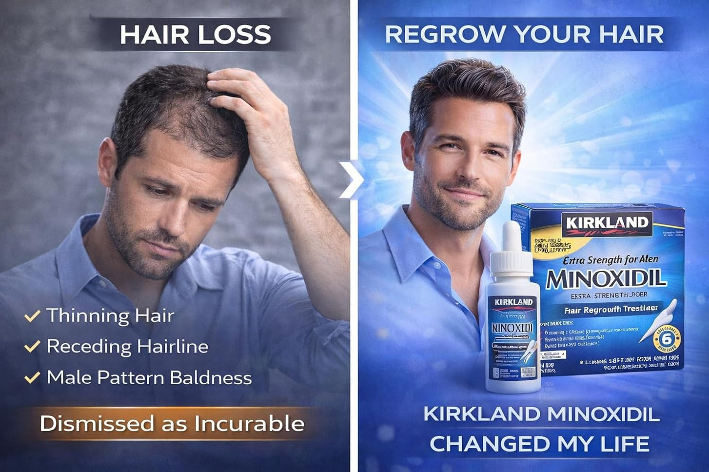 Kirkland Minoxidil 5% Extra Strength Men Hair Regrowth (12 Month Supply) | 5% minoxidil topical solution for men; extra strength hair regrowth treatment; unscented; 12 month with dropper