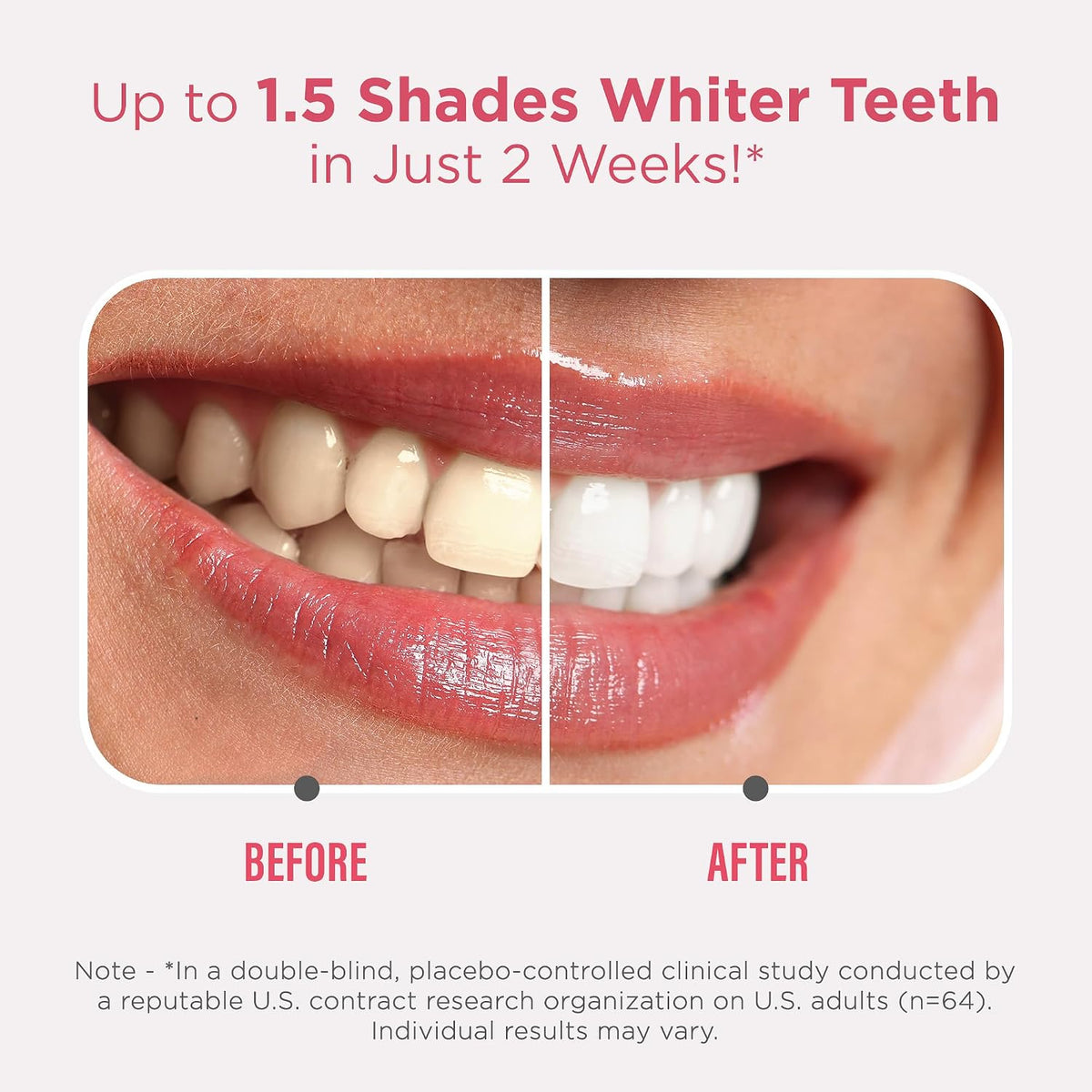 GuruNanda Sensitive Teeth Whitening Strips, Gentle & Safe, 9 Day Treatment