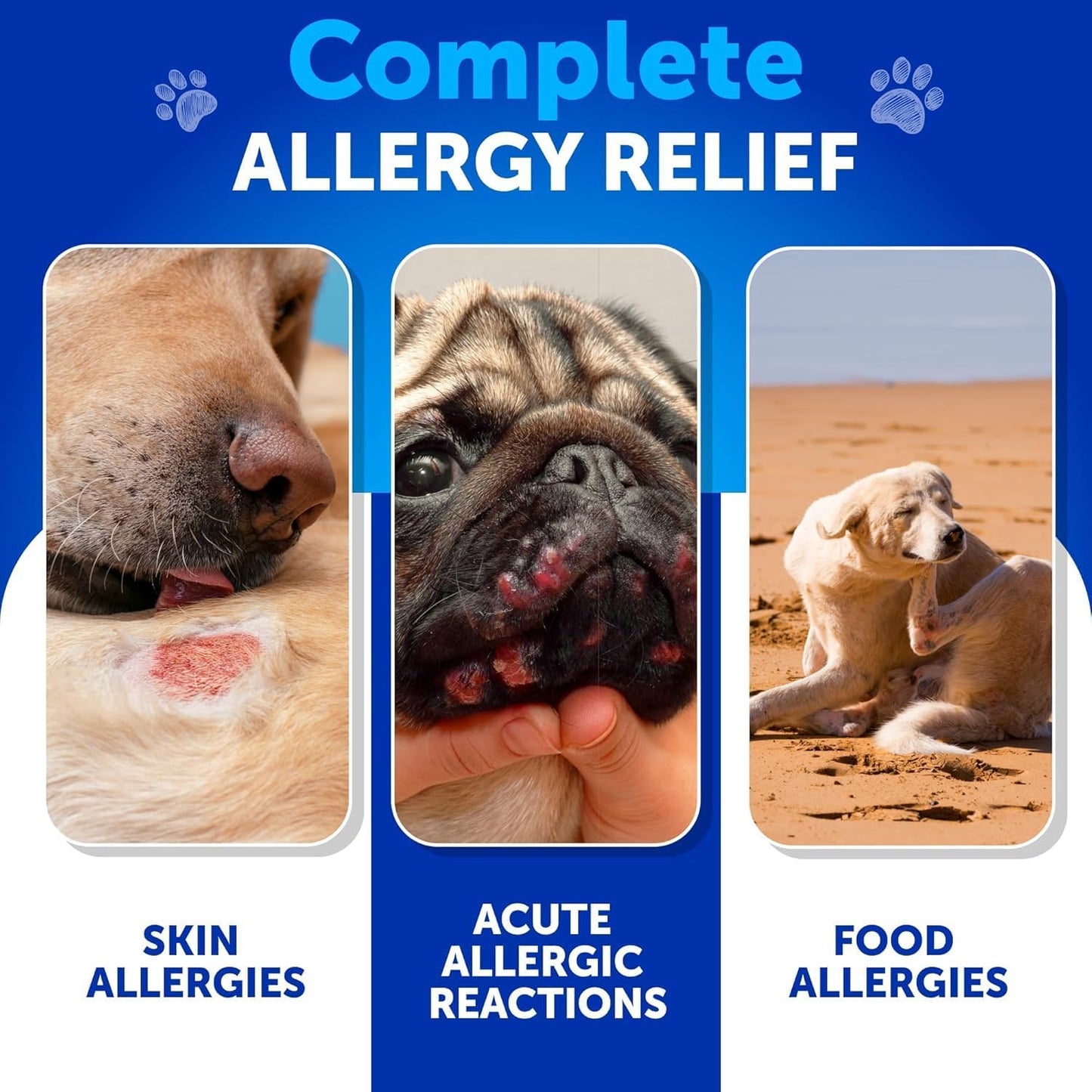 20 in 1 Dog Multivitamin + Allergy Relief Chews Bundle - Vitamins for Hip & Joint Support, Immunity, Mobility - Omega 3 for Skin & Coat, Anti-Itch, Hot Spots Treatment, Seasonal Allergy