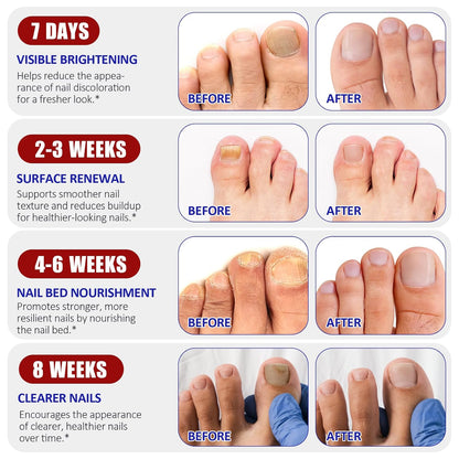 Nail Patches, 32 Pcs Toenail Care Patches for Dry, Weak & Cracked Nails, Deeply Moisturizing Nail, Protector and Improve the Appearance for Toenails