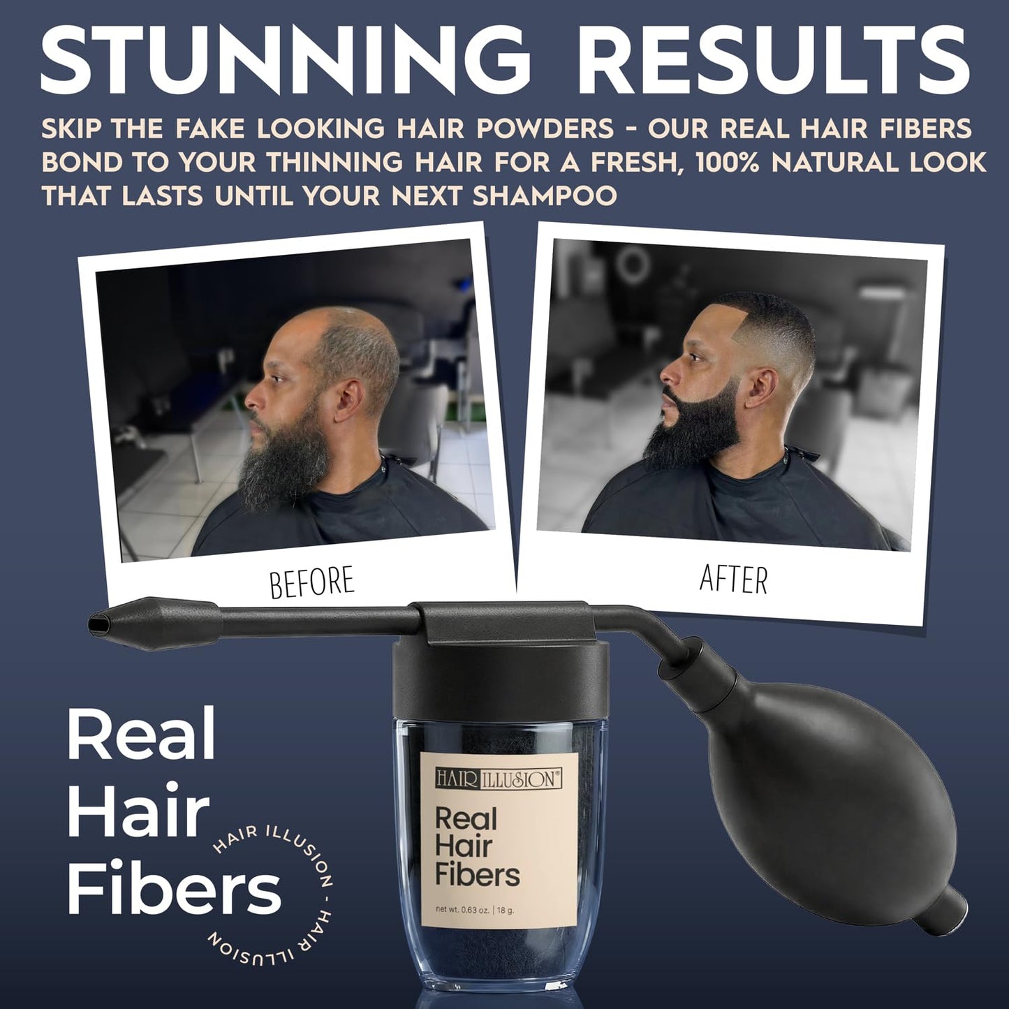 Hair Illusion Spray Applicator Removable Flat Tip designed to Spray Precise Hairline or Remove Tip For Round Sprayer And Wide Coverage (does not include hair fibers)