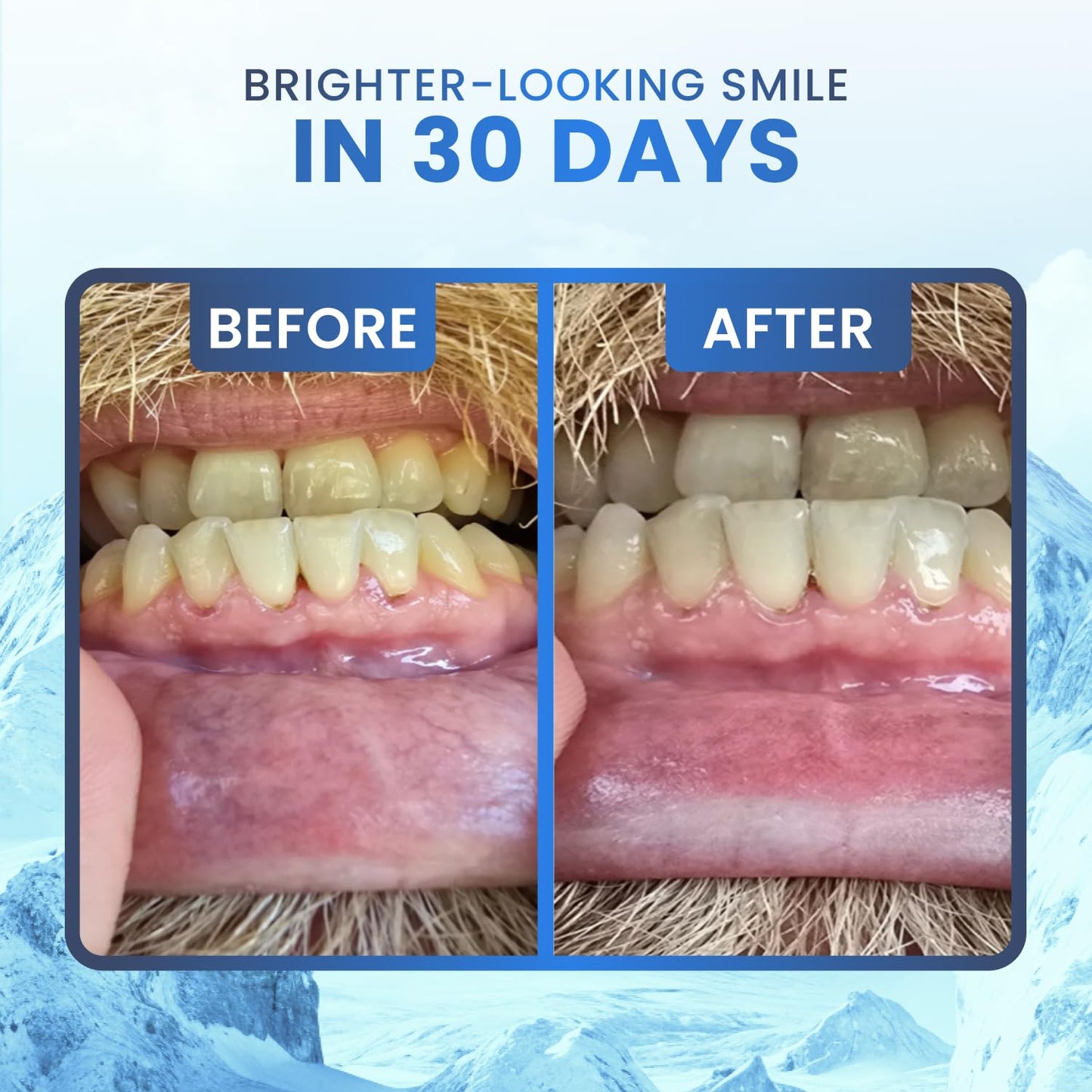 Larineco Remineralizing Gum with Nano Hydroxyapatite & Xylitol – Sugar-Free Xylitol Gum – Plastic-Free, Dye-Free, Aspartame-Free – Natural Base – 36 Pieces, Mastic Mint