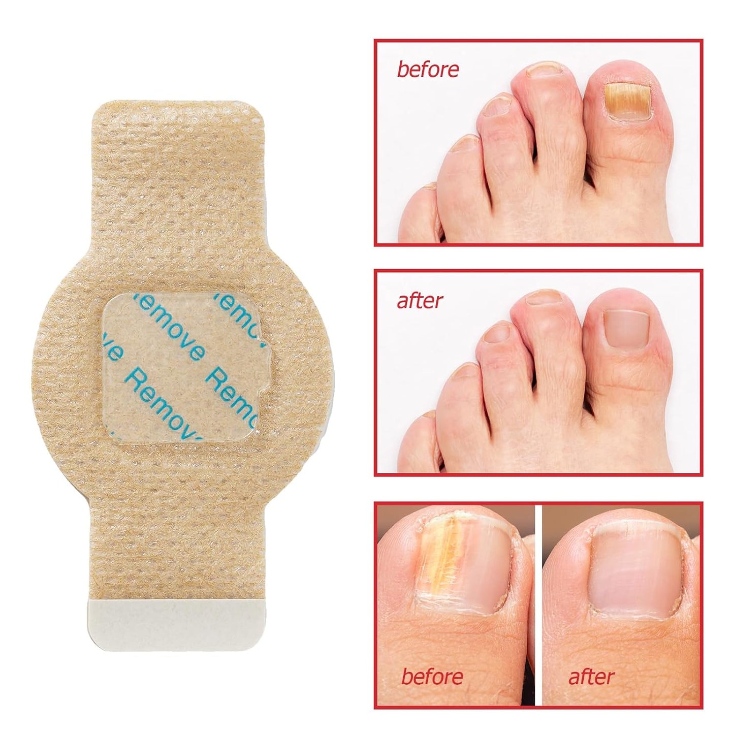 Nail Patches, 21 Pcs Toenail Care Patches Overnight Nail Care, Support the Appearance of Dry, Rough, & Brittle Toenails, Moisturizing Dry Nails for Men and Women