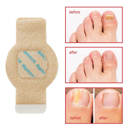 Nail Patches, 21 Pcs Toenail Care Patches Overnight Nail Care, Support the Appearance of Dry, Rough, & Brittle Toenails, Moisturizing Dry Nails for Men and Women