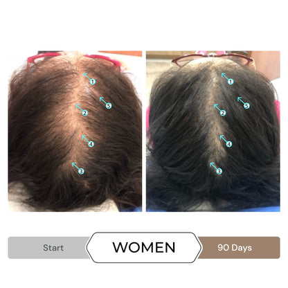 Revita Shampoo and Spectral.DNC-N Serum for Hair Thinning by DS Laboratories