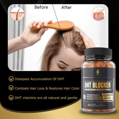 DHT Blocker Gummies Hair Growth Supplement, Super Potency Saw Palmetto & Biotin 10000 mcg for Women & Men, Plus 12 Proprietary Blend - Prevent Hair Loss, Blocking DHT Receptors, Balance