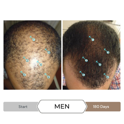 Revita Shampoo and Spectral.DNC-N Serum for Hair Thinning by DS Laboratories