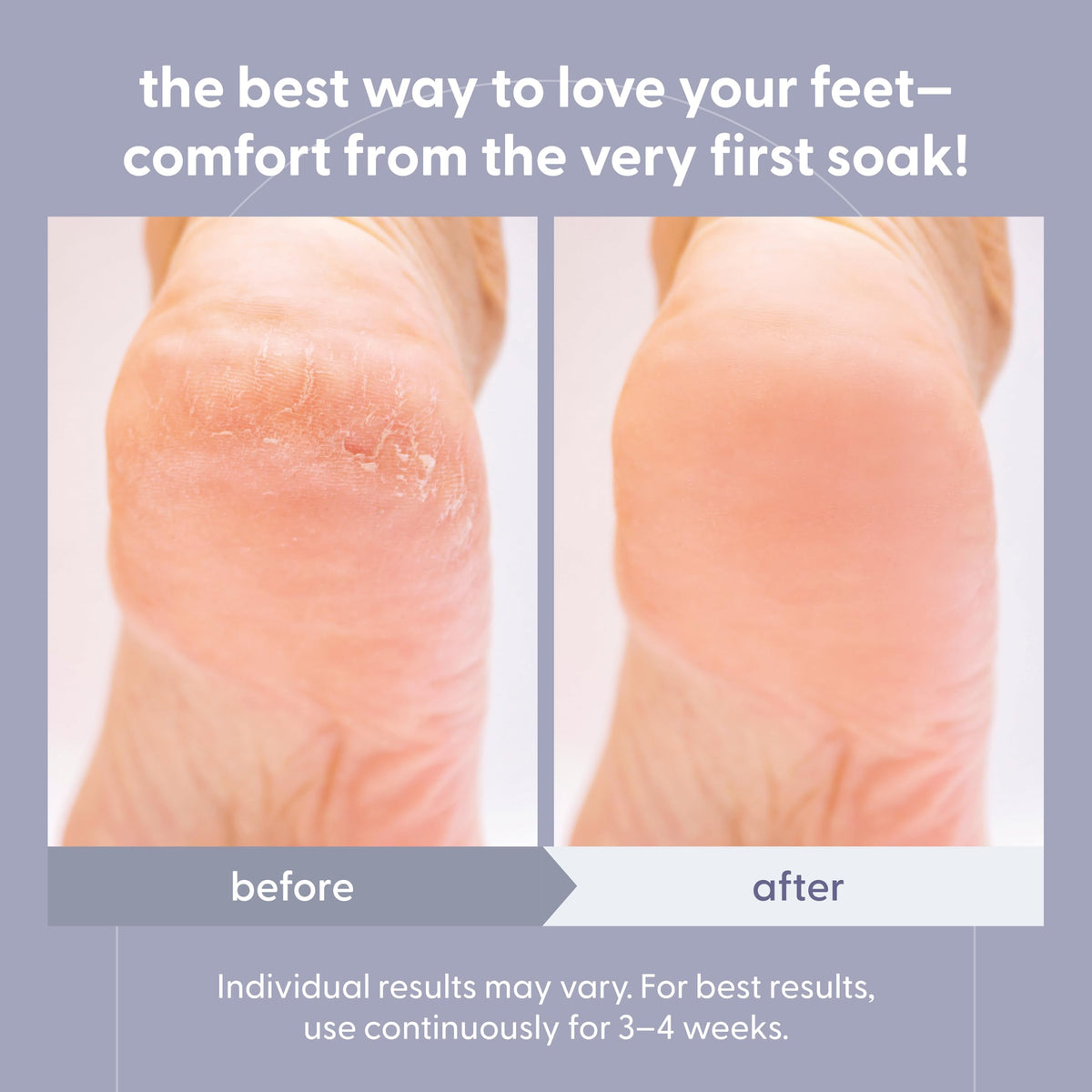 Soothing Tea Tree Oil Foot Soak with Stem Cell and Epsom Salt, 16 oz by M3