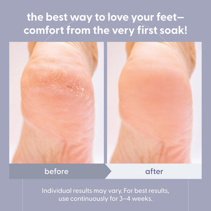 Soothing Tea Tree Oil Foot Soak with Stem Cell and Epsom Salt, 16 oz by M3