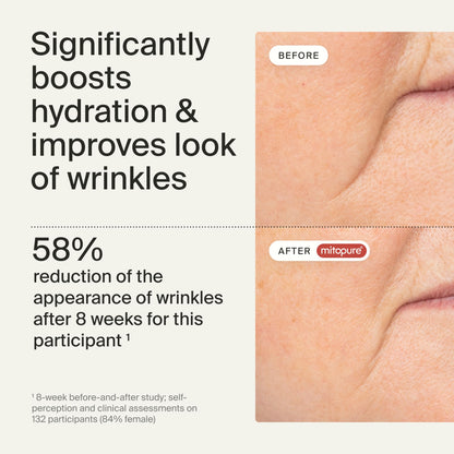 Timeline Mitopure™ Barrier Cream Nourishing Moisturizer With Peptides to Restore Dry Skin & Strengthen Barrier - 1.7 Fl Oz