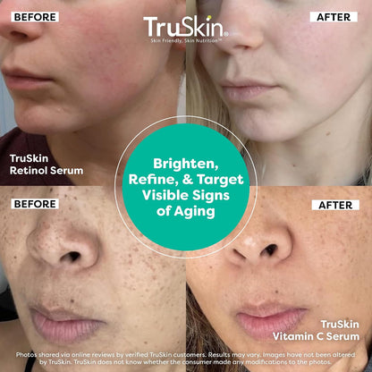 TruSkin Face Serum Duo - Vitamin C Serum & Retinol Serum for Face - AM & PM Anti Aging Skincare Routine - Brightening & Smoothing Facial Serums, 1 fl oz Each