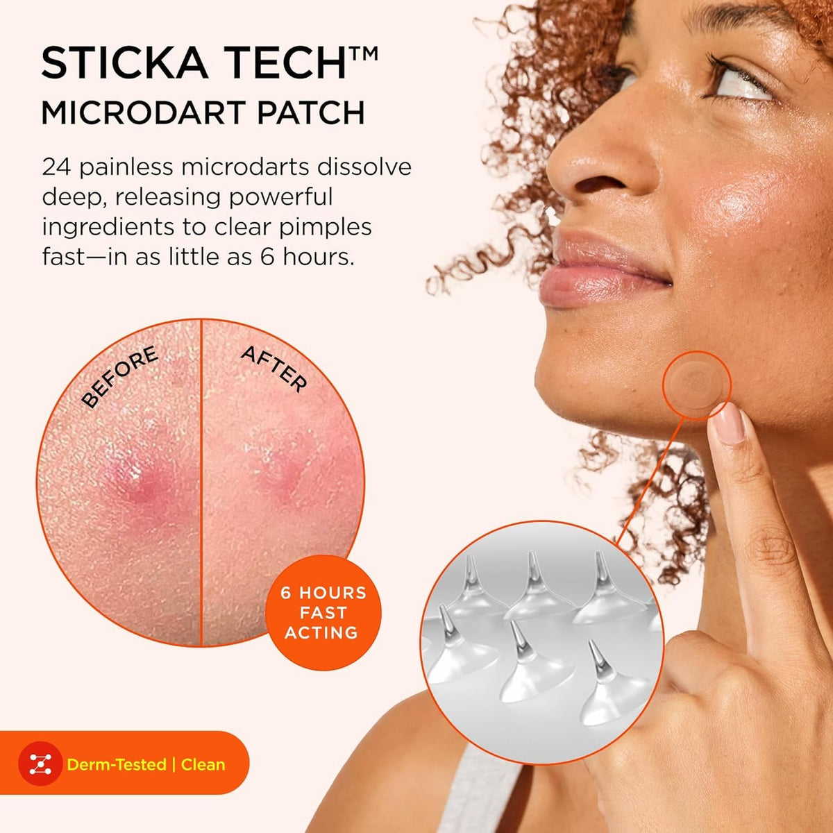 ZitSticka Killa Kit Microdart Pimple Patch For Face, Fast-Acting, 8 Count