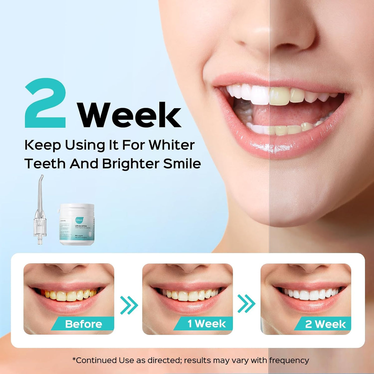 COSLUS Water Dental Flosser Teeth Pick: Portable Cordless Oral Irrigator + Whitening Water Flosser Replacement Tips with 60 Pcs Mint Refills: Compatible with C20 (F5020E) & E40 (WFP14)