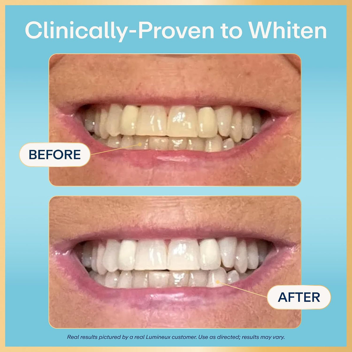 Lumineux 2-in-1 Teeth Whitening Pen, Removes Coffee & Tea Stains