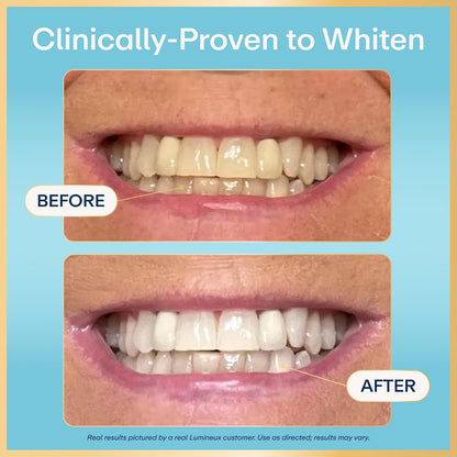 Lumineux 2-in-1 Teeth Whitening Pen, Removes Coffee & Tea Stains