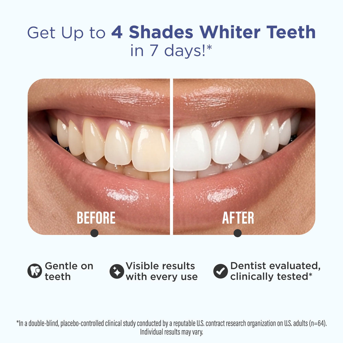 GuruNanda Teeth Whitening Strips - 4X Whiter Teeth, 7-Day Whitening Kit