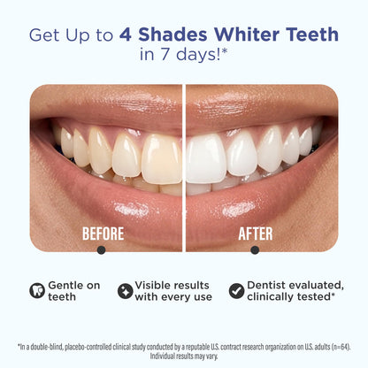 GuruNanda Teeth Whitening Strips - 4X Whiter Teeth, 7-Day Whitening Kit