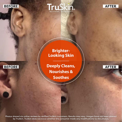 TruSkin Vitamin C Brightening Face Wash with Rosehip Oil, 4 fl oz | Vitamins C & E, Aloe Vera and MSM gently cleanse, refresh and support radiant-looking skin without over-drying