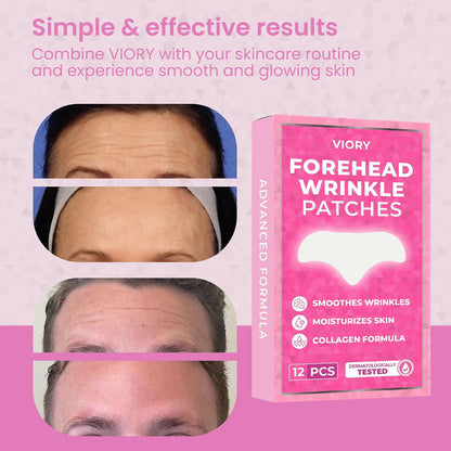VIORY Forehead Wrinkle Patches Smoothing Overnight - Anti Wrinkle Patches | For Face And Forehead Fine Lines & Frown Lines, With Aloe, Collagen, Vitamin E, Hyaluronic Acid, 12 Pcs