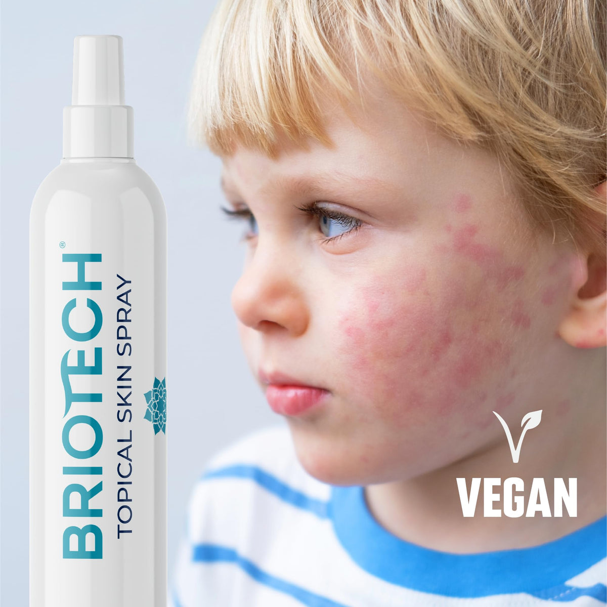 BRIOTECH Hypochlorous Acid Spray, Topical Skin Face & Body Mist, Support Irritations