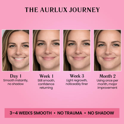 Trilogy Facial Hair Removal Kit for Women, Chin, Upper Lip & Jawline | 3-step facial hair removal kit for coarse hormonal hair; lasts 3–4 weeks with soothing aloe, vitamin E and chamomile gel.