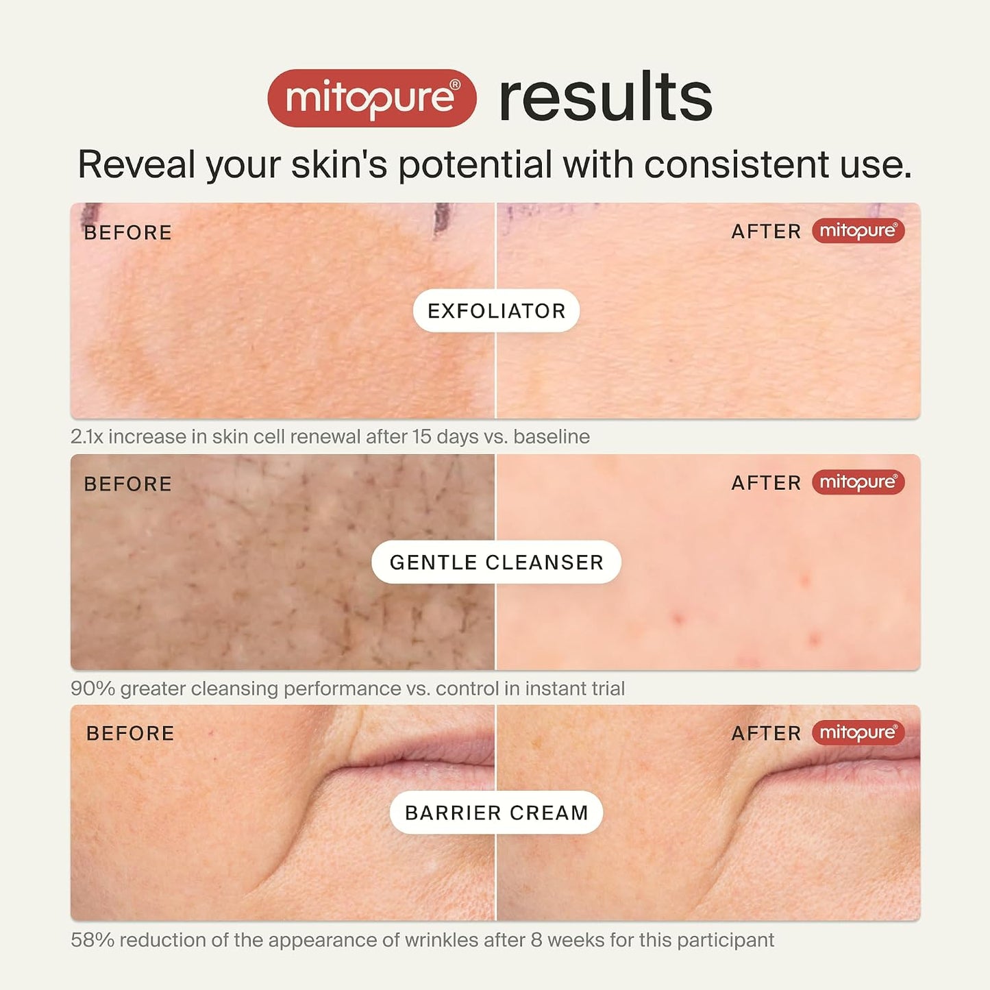 Timeline Mitopure Skincare Routine Starter Kit in Travel Case with Gentle Cleanser 50 ml, Resurfacing Exfoliator 30ml & Barrier Cream 15 ml for All Skin Types