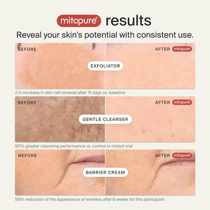 Timeline Mitopure Skincare Routine Starter Kit in Travel Case with Gentle Cleanser 50 ml, Resurfacing Exfoliator 30ml & Barrier Cream 15 ml for All Skin Types