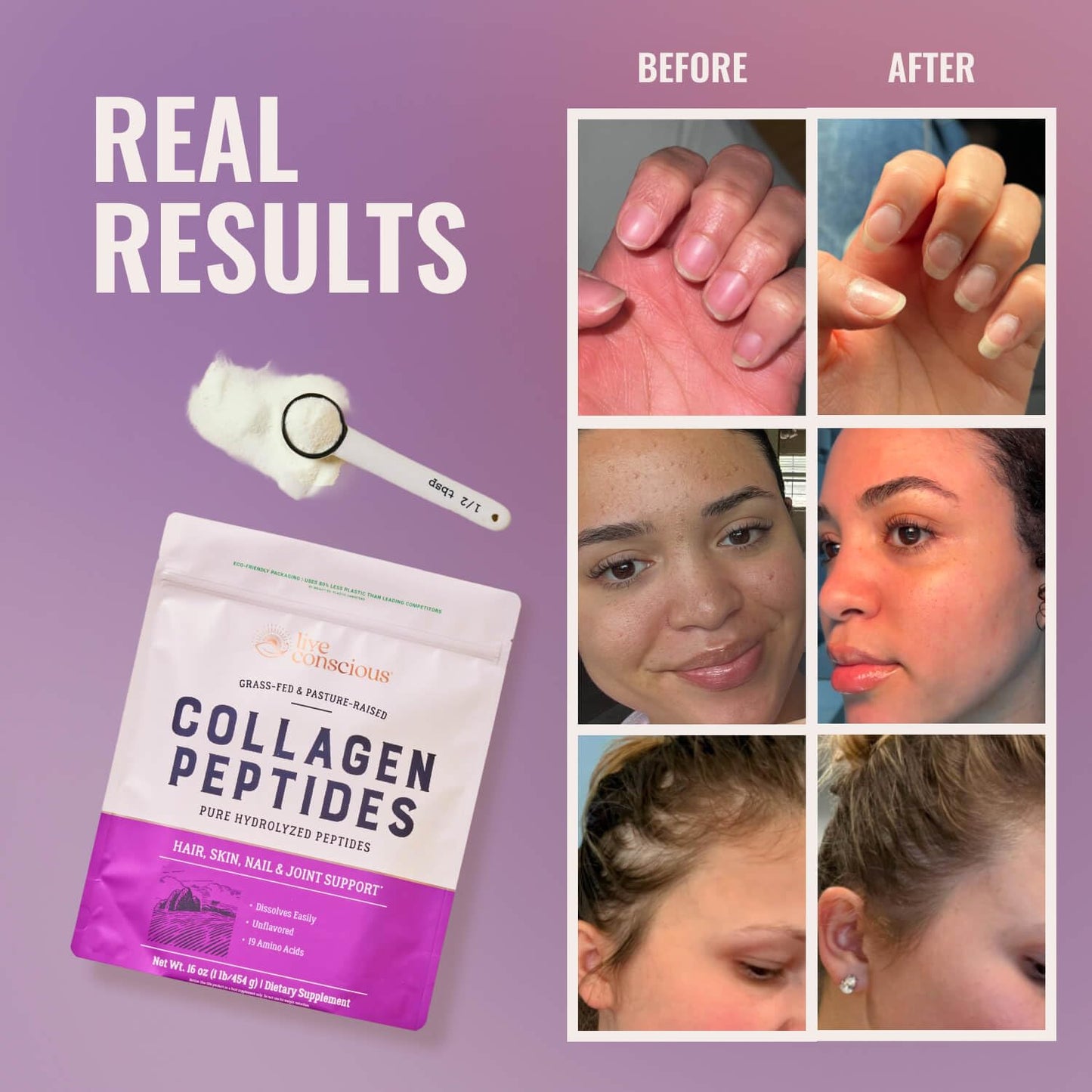 Live Conscious Collagen Peptides Powder - Naturally-Sourced Hydrolyzed Collagen Powder - Hair, Skin, Nail, and Joint Support - Type I & III Grass-Fed Collagen Supplements for Women and Men - 16oz
