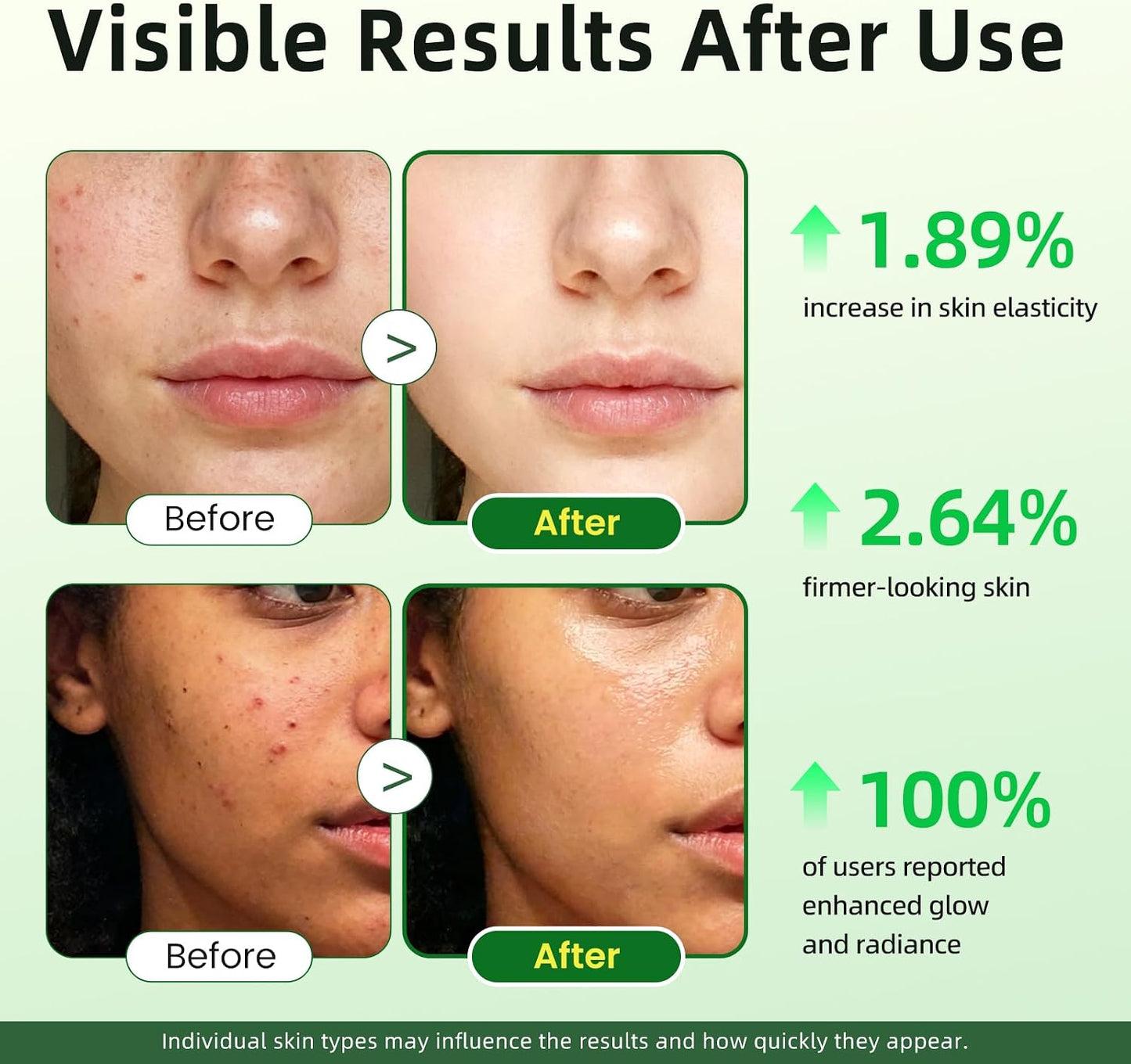 Lukaree Vitamin C Serum for Face, Dark Spots, Fine Lines & Support Collagen | Vitamin C Serum 20% Brightening Face Serum with Sodium Hyaluronate - All Skin Types, Plus Vit C Caps, 1 Fl Oz + 60 Caps