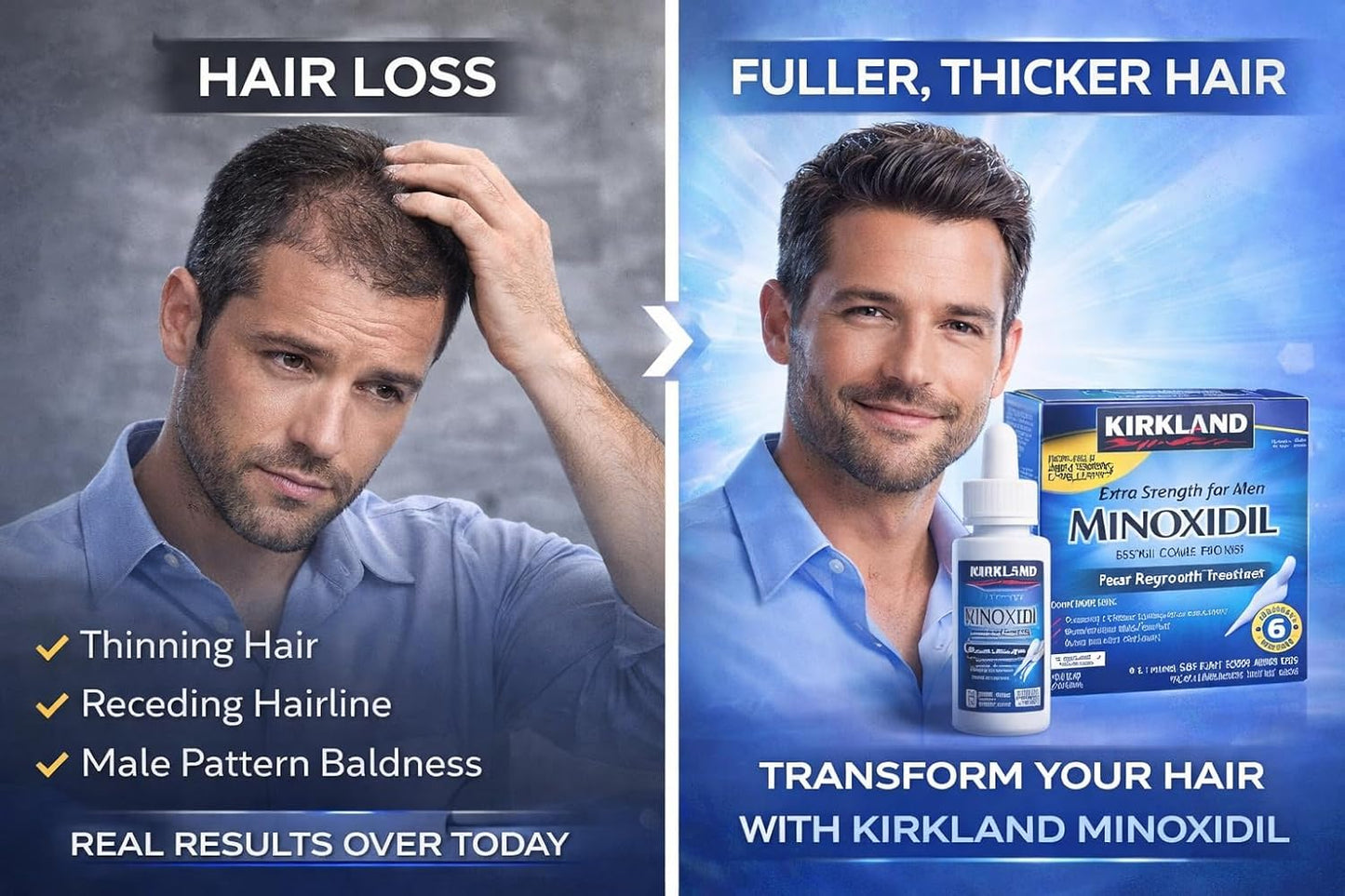 Kirkland Minoxidil 5% Extra Strength Men Hair Regrowth (12 Month Supply) | 5% minoxidil topical solution for men; extra strength hair regrowth treatment; unscented; 12 month with dropper