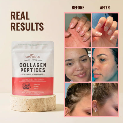 Live Conscious Collagen Peptides Powder - Naturally-Sourced Hydrolyzed Collagen Powder - Hair, Skin, Nail, and Joint Support - Type I & III Grass-Fed Collagen Supplements for Women and Men - 16oz