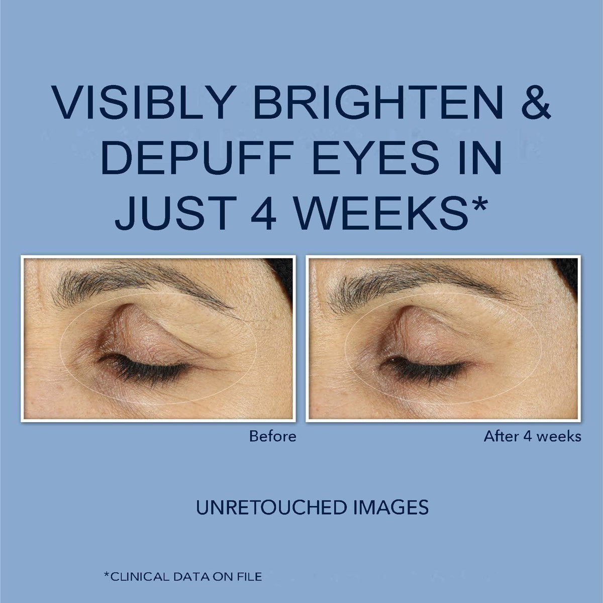 RoC Retinol Correxion Eye Cream Mini for Dark Circles & Puffiness, Daily Wrinkle