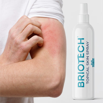 BRIOTECH Pure Hypochlorous Acid Spray, Multi Purpose Topical Body & Facial Mist, Eyelid