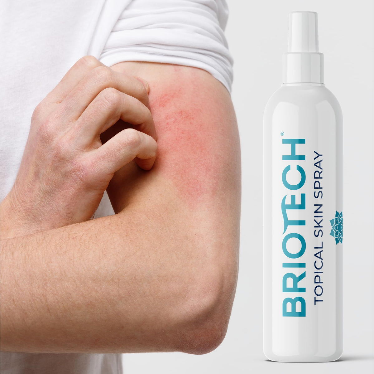 BRIOTECH Hypochlorous Acid Spray, Topical Skin Face & Body Mist, Support Irritations