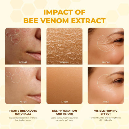 MONIER Bee Venom Cream | Hydrating, Smoothing, Firming, Wrinkle-Reducing | Comprehensive Bee Venom Skin Treatment Cream (Enhanced Formula)