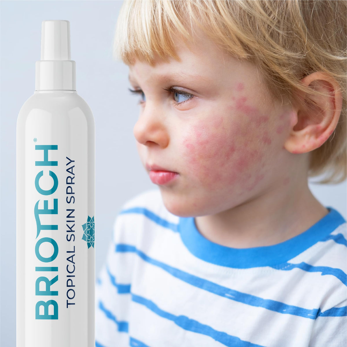 BRIOTECH Pure Hypochlorous Acid Spray, Multi Purpose Topical Body & Facial Mist, Eyelid
