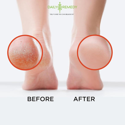 Muscle Relief Foot Soak with Epsom Salt, Made in USA, Soothe Foot Aches, Muscle Pain