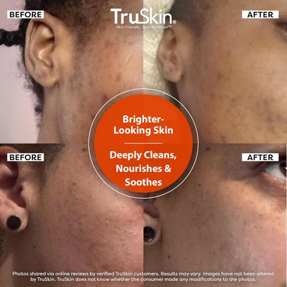 TruSkin Vitamin C Brightening Face Wash with Rosehip Oil, 4 fl oz | Vitamins C & E, Aloe Vera and MSM gently cleanse, refresh and support radiant-looking skin without over-drying