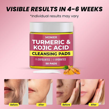 Turmeric Kojic Acid Cleansing Pads for Face Dark Spots - Hydrates & Plumps | With Vitamin C & E, Sensitive Skin Friendly (50 Pads)