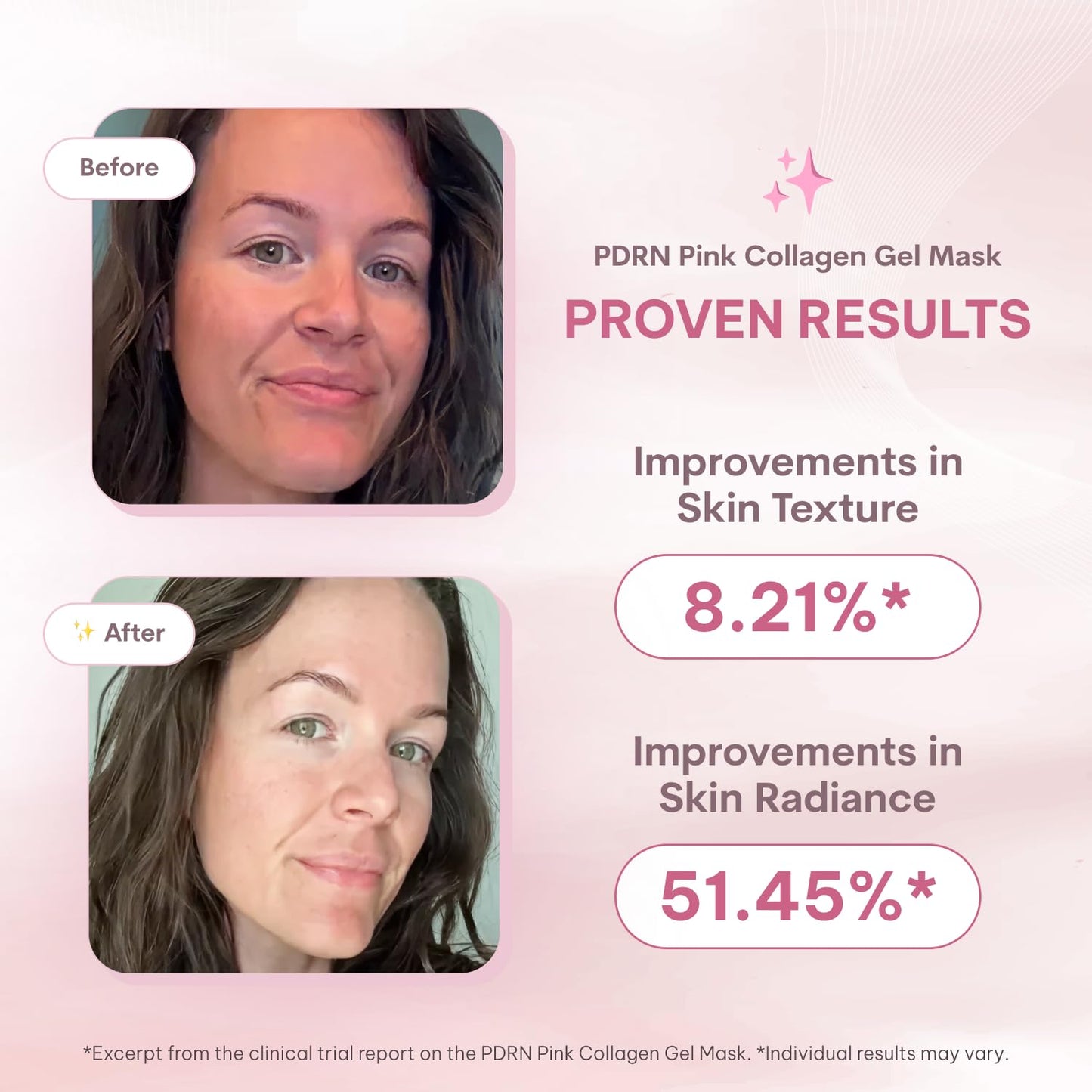 Quasi Salmon PDRN Collagen Mask – Korean Skin care Gel Face Mask for Hydration, Firming & Smoothing Skincare, Collagen Boost & Pore Care – 4 Masks, Non-Irritating, Natural Ingredients