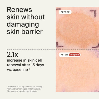 Timeline Mitopure™ Resurfacing Face Exfoliator- with Plant-Based Acids to Purify, Tone, Hydrate, Refine Texture & Unclog Pores - 3.38 Fl Oz